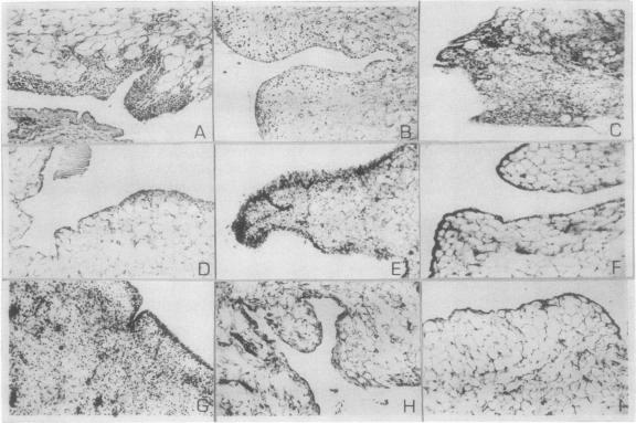 graphic file with name annrheumd00112-0104-a.jpg