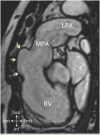 Figure 32