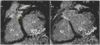 Figure 34
