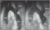 Figure 44