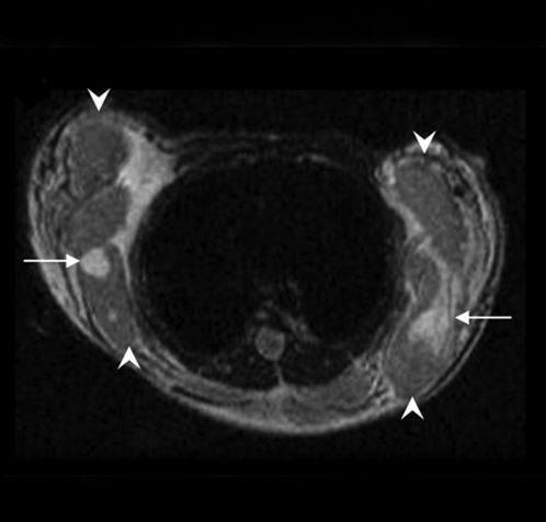 Figure 2c: