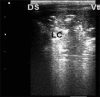 Figure-3