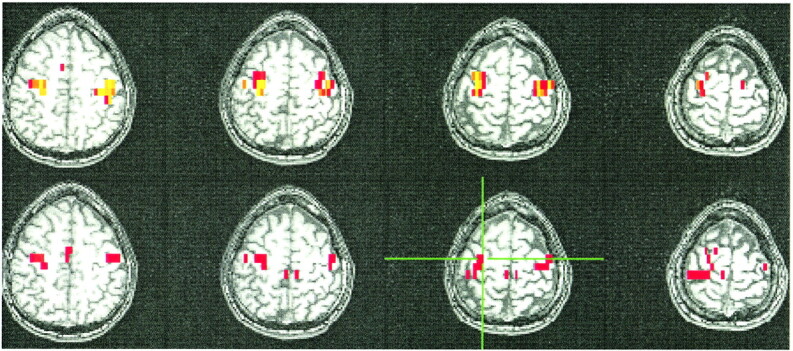 fig 4.