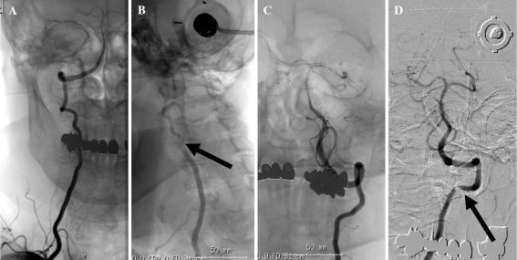 Fig. 1