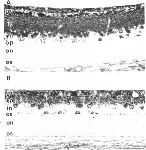 graphic file with name pnas00276-0378-a.jpg