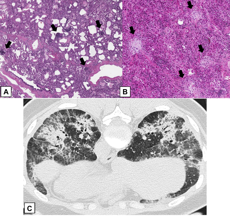 Figure 22