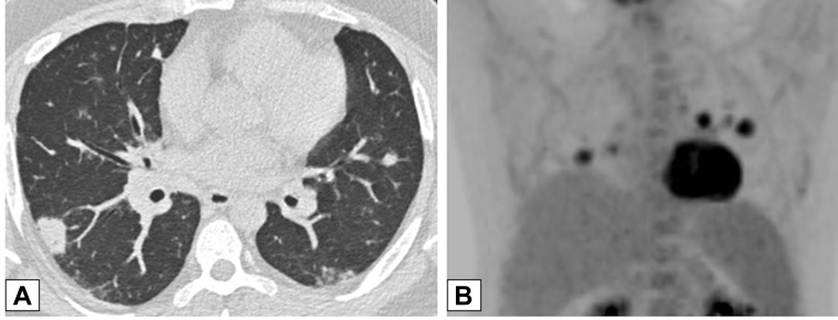 Figure 14