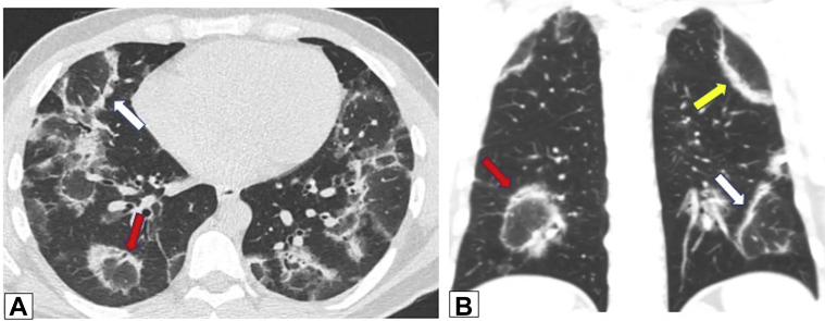 Figure 16