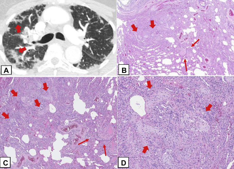 Figure 21