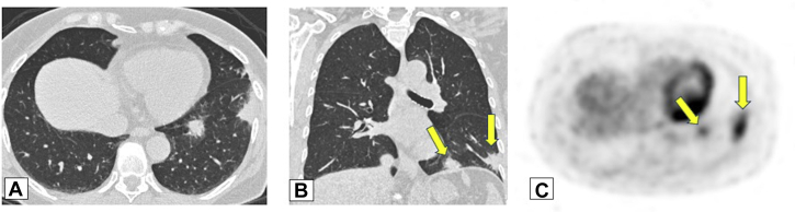 Figure 13