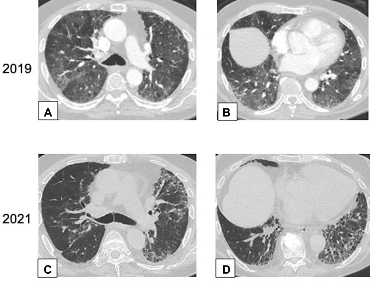 Figure 17