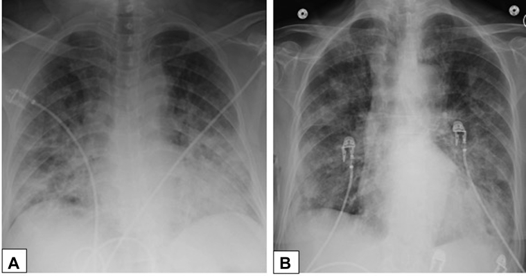 Figure 26