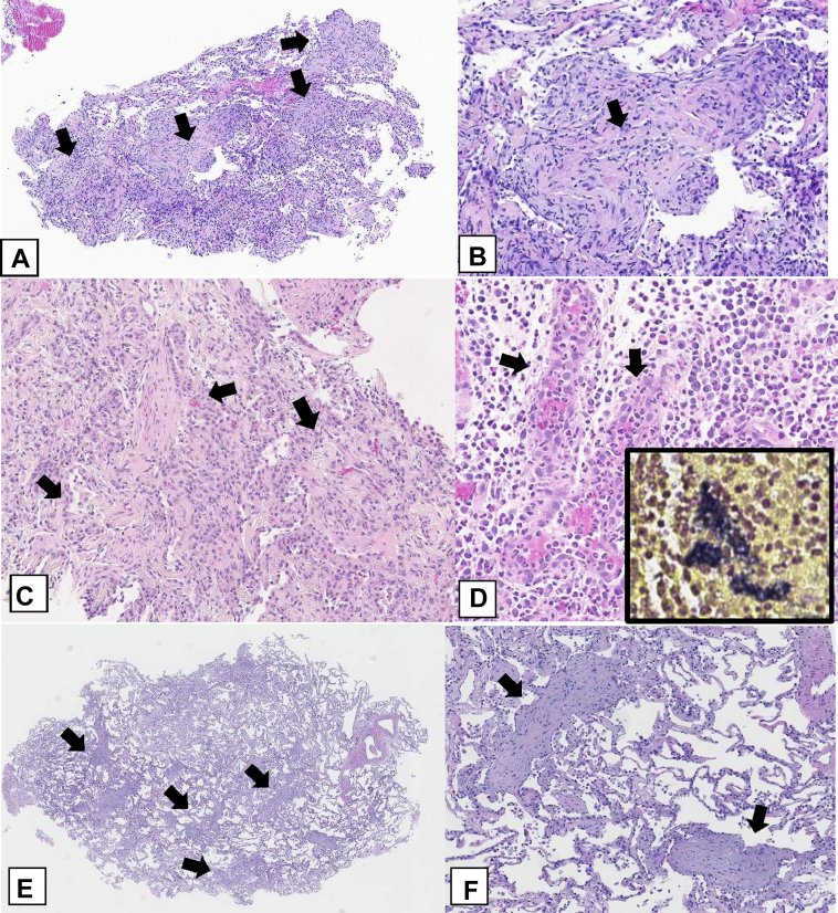 Figure 24