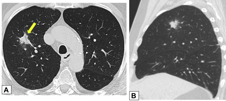 Figure 12