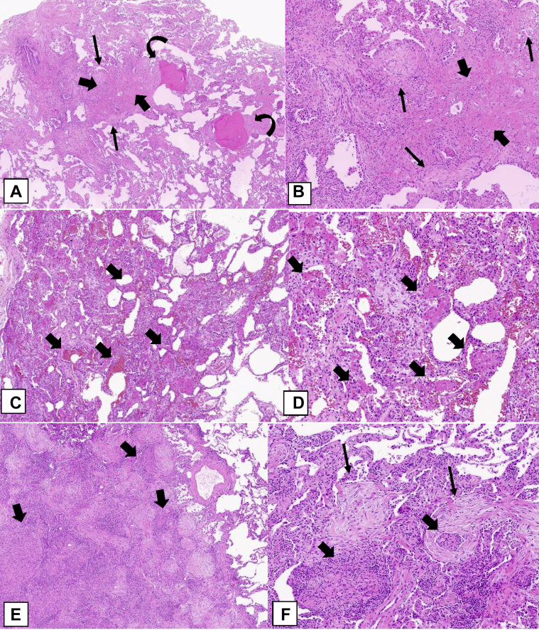 Figure 23