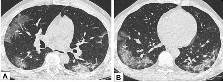 Figure 27