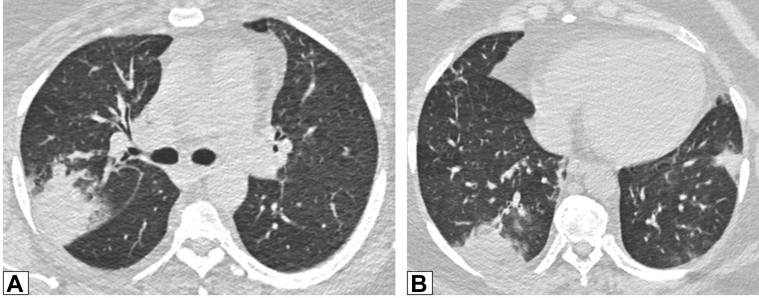 Figure 10