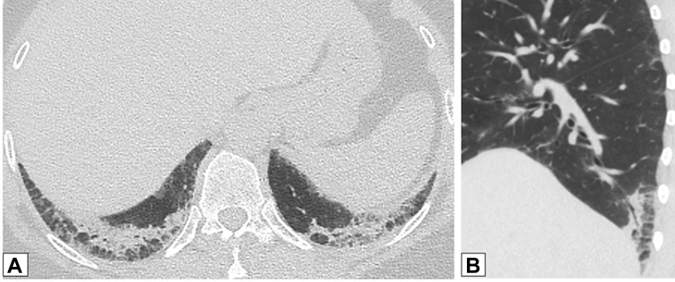 Figure 18