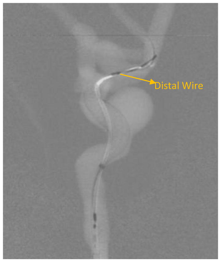 Figure 13