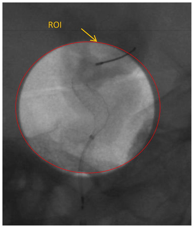 Figure 12