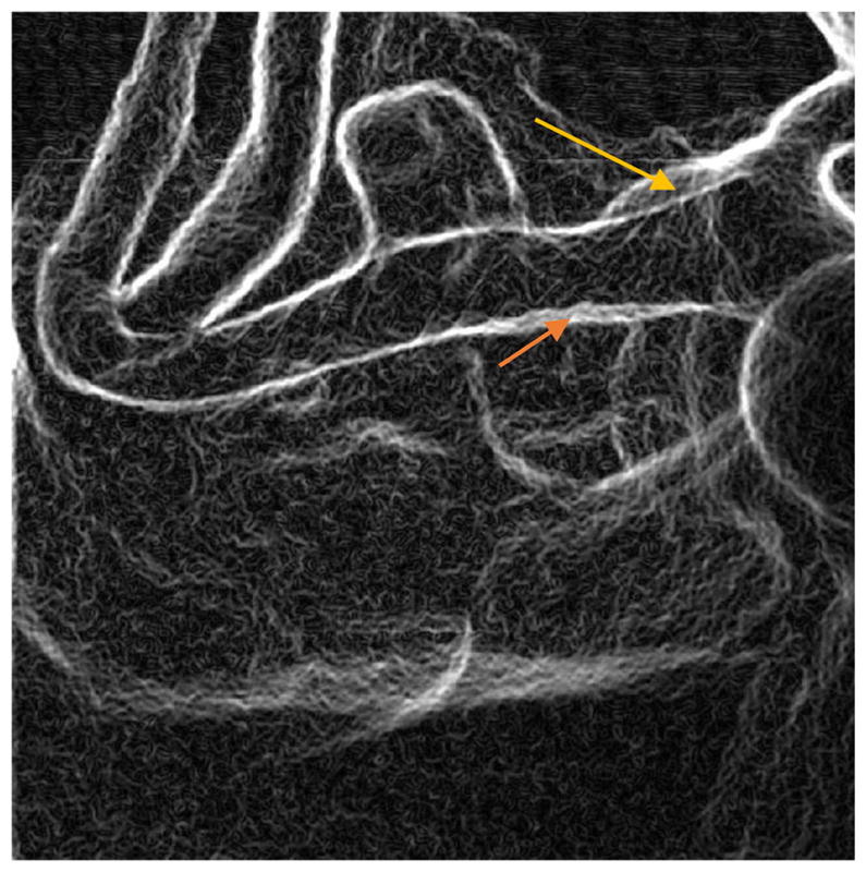 Figure 9