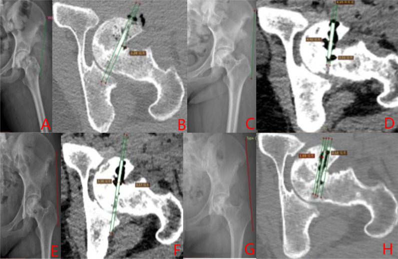 Fig. 16