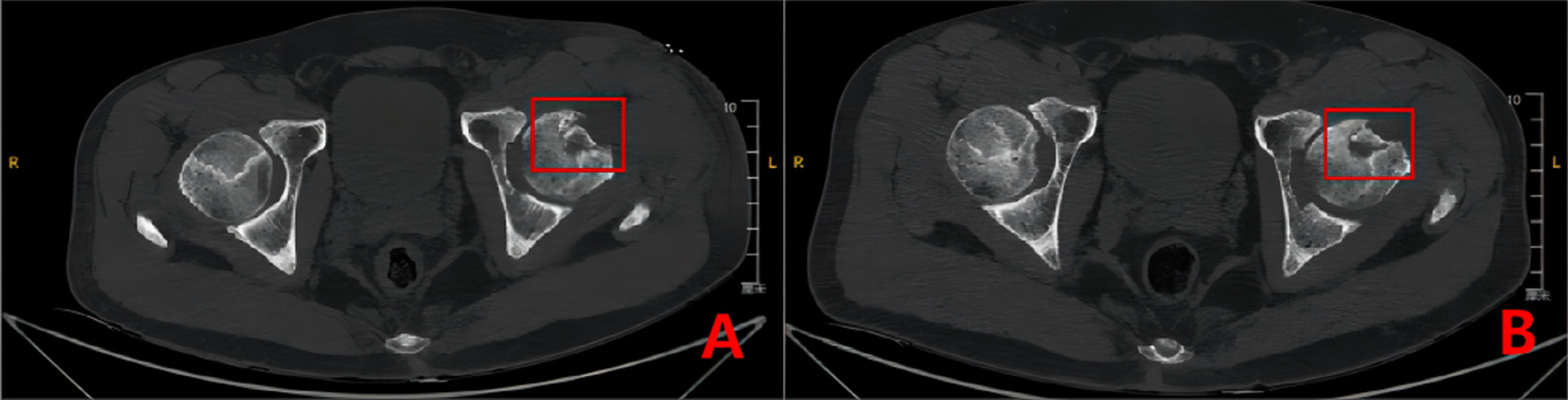 Fig. 18