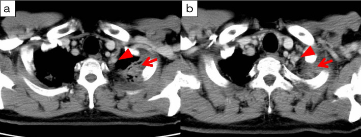 Fig. 3