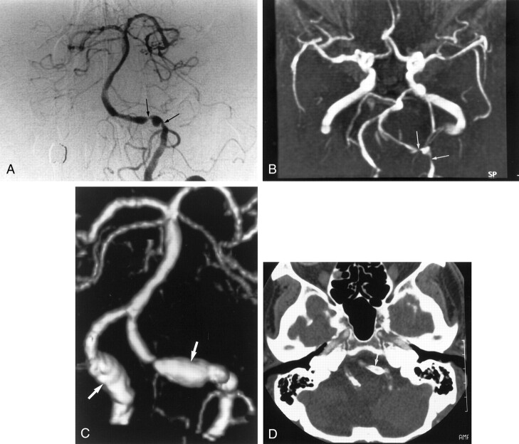 Fig 4.