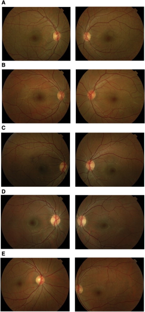 Figure 2