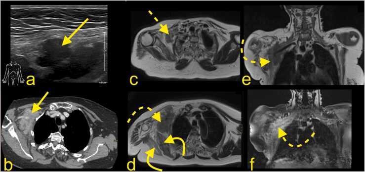 Fig. 11