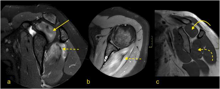 Fig. 10