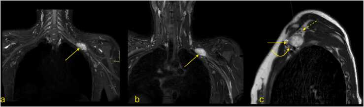 Fig. 14