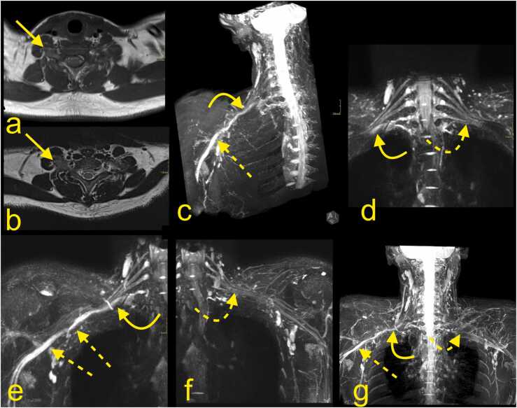 Fig. 16