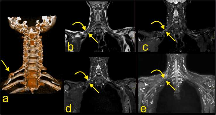 Fig. 15