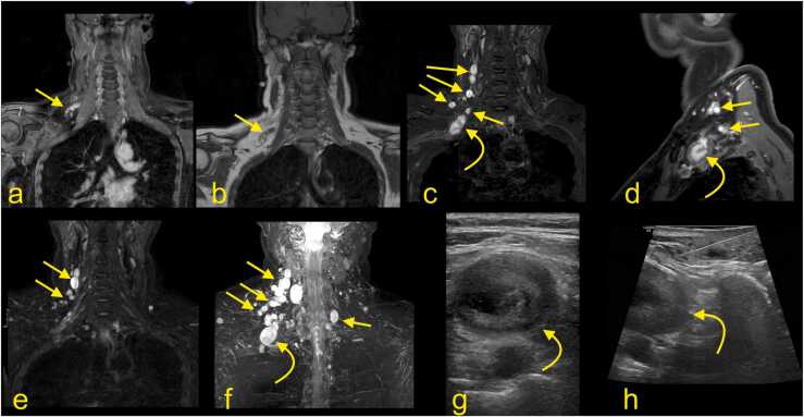 Fig. 13