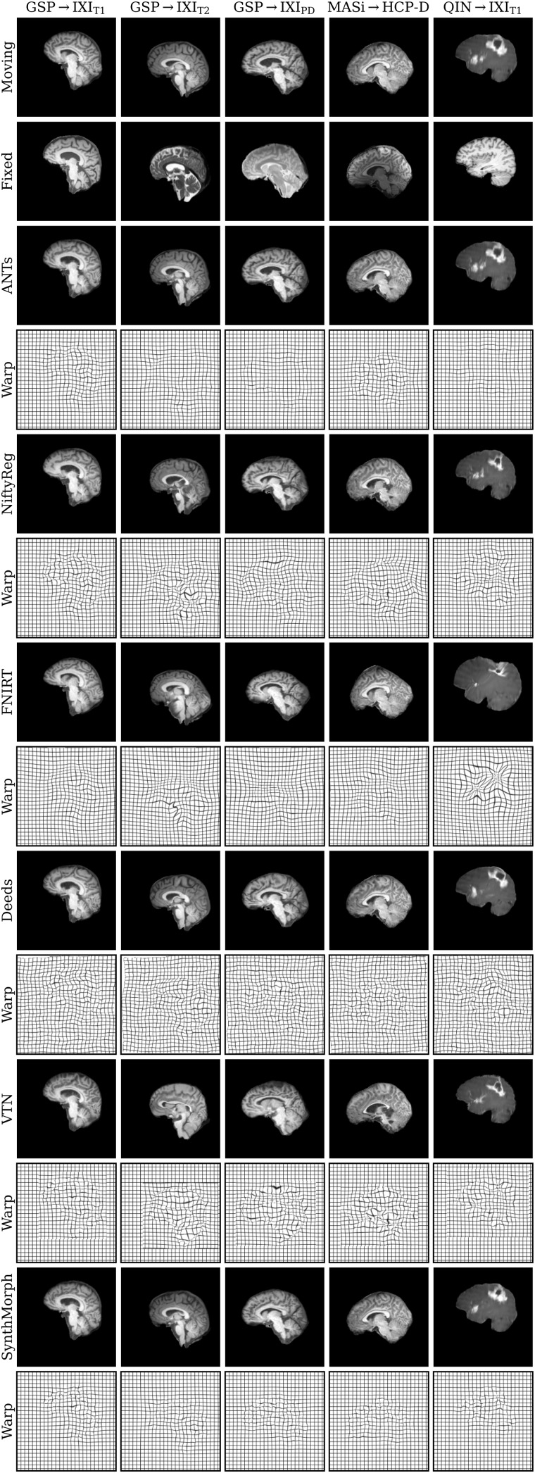 Fig. 11.