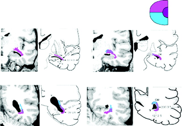 Fig 3.