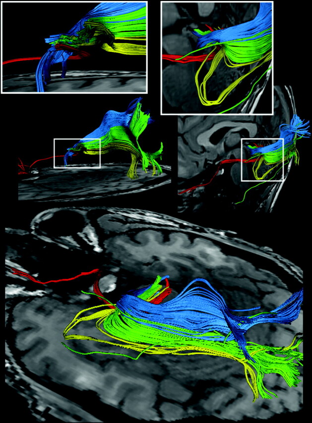 Fig 5.