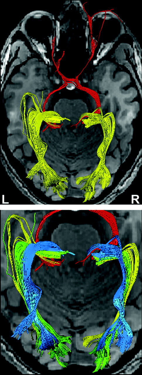 Fig 4.