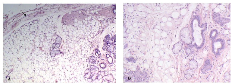 Fig. (1)