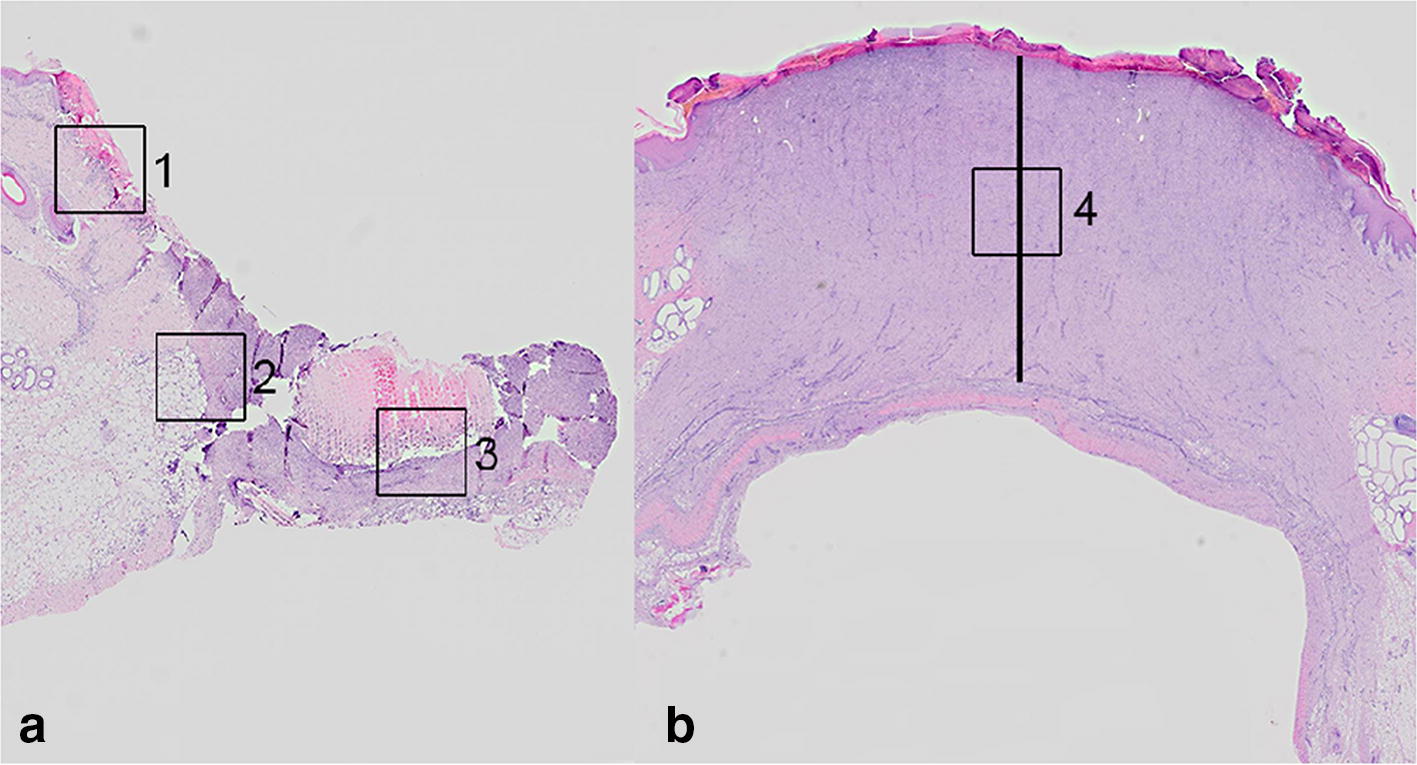 Fig. 2