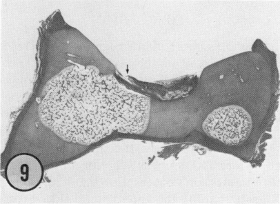 FIG. 9