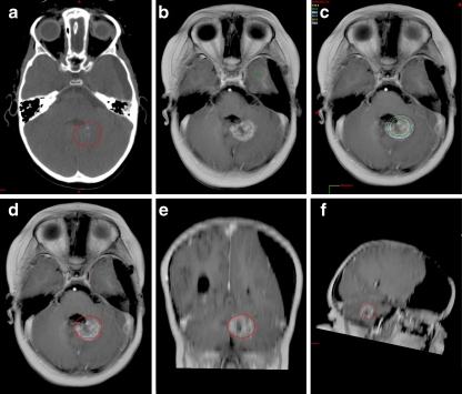 Fig. 4