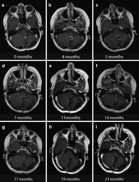 Fig. 2