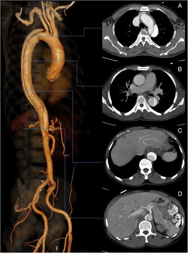 Figure 3