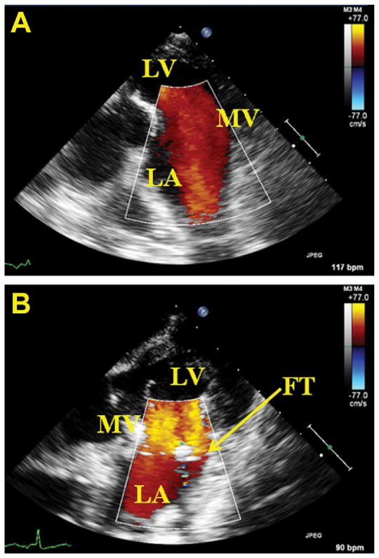 Fig 4