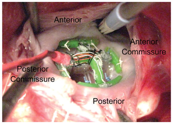 Fig 3