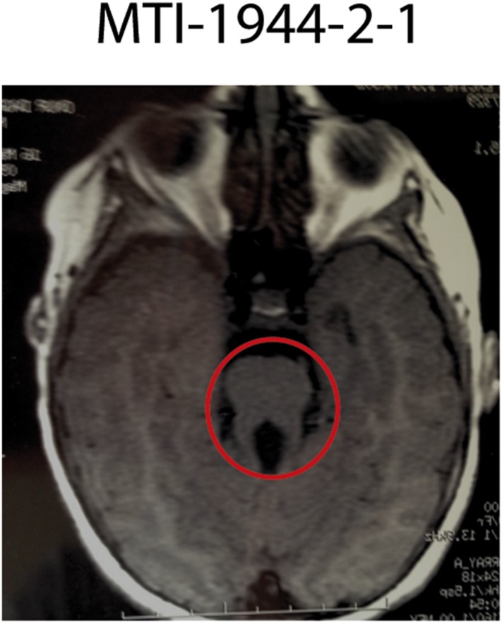 Figure 3—figure supplement 1.