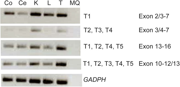 Figure 4—figure supplement 1.